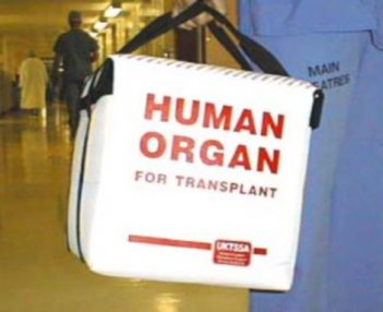 torba v kateri se prevaža darovani organ